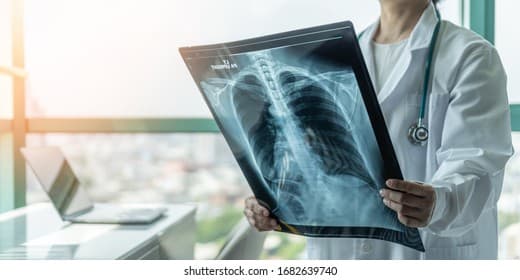 X-Ray icon